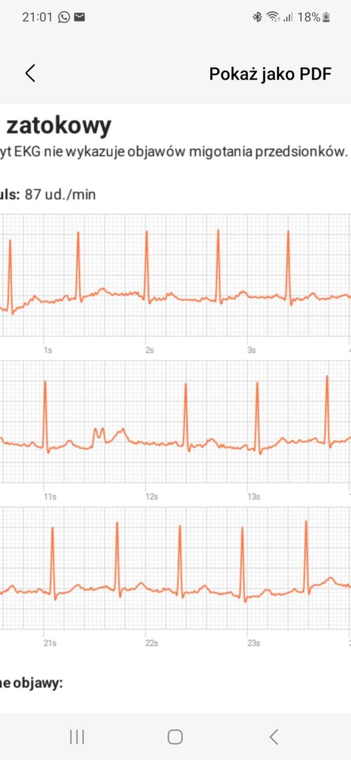 Ryzyko i powikłania skurczów serca