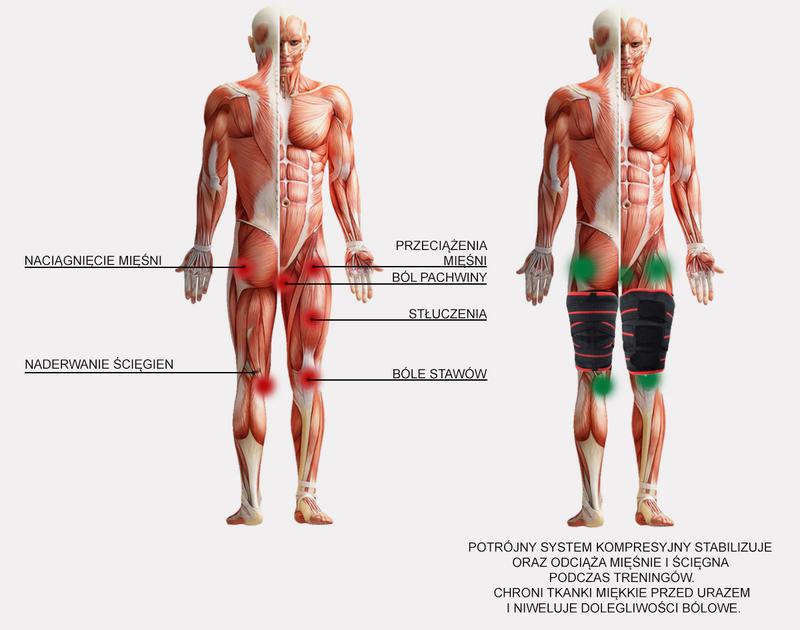 Objawy kontuzji pachwiny