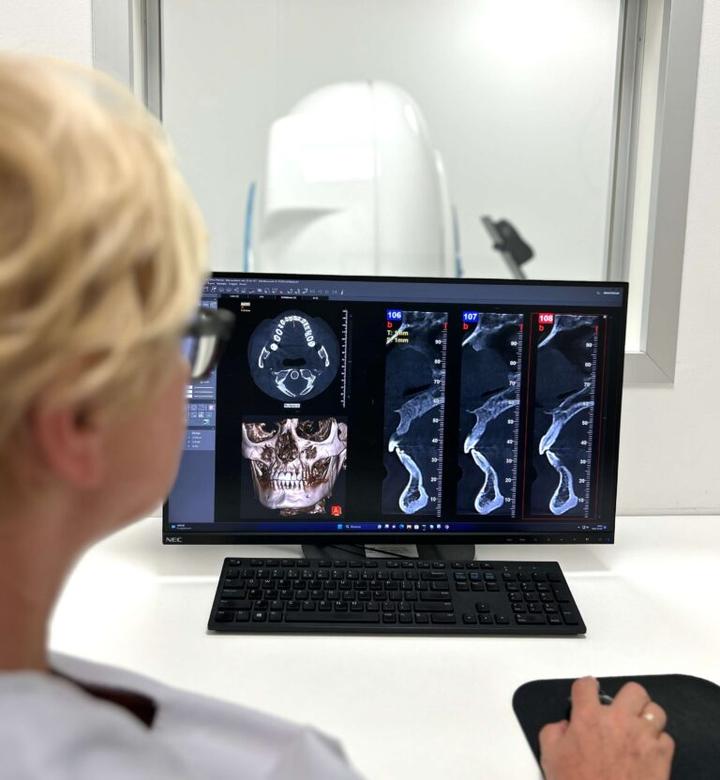 Objawy zapalenia mięśnia trójdzielnego