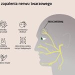 Jak rozpoznać zapalenie mięśnia trójdzielnego twarzy? Objawy, na które warto zwrócić uwagę