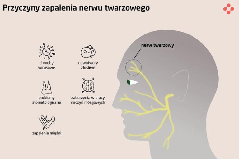 Jak rozpoznać zapalenie mięśnia trójdzielnego twarzy? Objawy, na które warto zwrócić uwagę