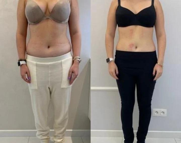 Skuteczne metody na odchudzanie brzucha bez ćwiczeń – zapytaj jak to zrobić!