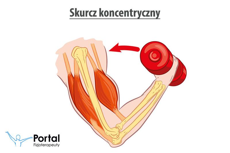 Objawy skurczów mięśni
