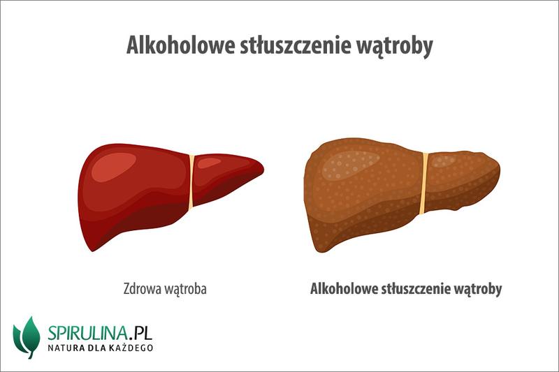 Produkty wspierające regenerację wątroby