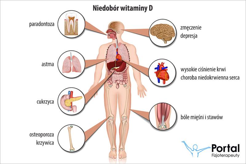 Wsparcie siły mięśniowej