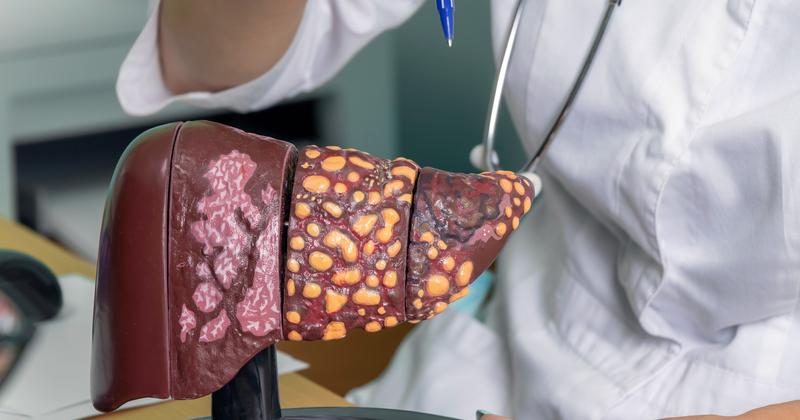 Zasady diety na stłuszczenie