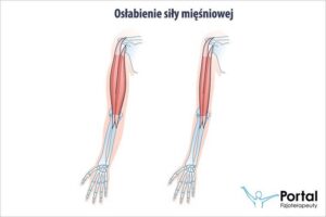 Objawy osłabienia mięśni nóg – jak je rozpoznać i kiedy udać się do lekarza?