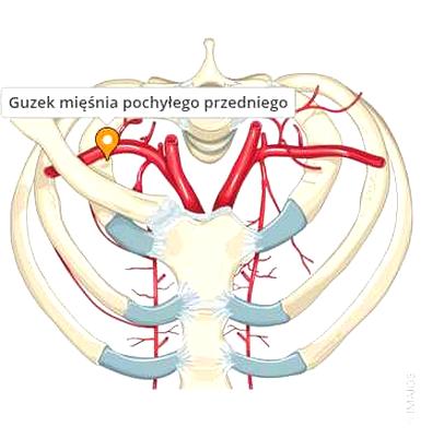 Diagnostyka guzów mięśnia uda