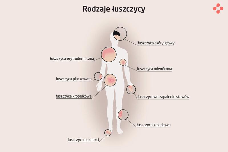 Zdrowa skóra